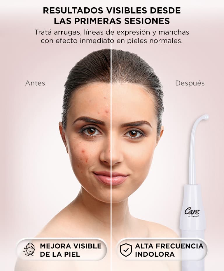 Imagen 4 del producto